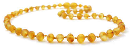 Amber Honey Raw Children Necklace-2